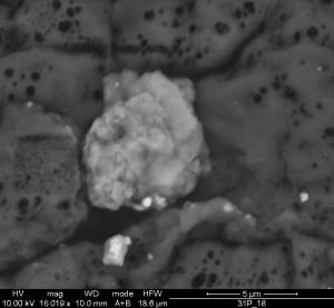 Ziarna węglanu wapnia (jasne) wytrącone na cząstkach pyłów atmosferycznych w tkance płucnej,
widziane pod skaningowym mikroskopem elektronowym