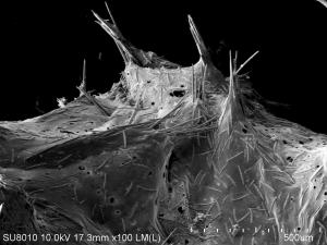 Powierzchnia nadecznika stawowego (Spongilla lacustris L.) obserwowana w elektronowym mikroskopie skaningowym.
Widoczne mikrosklereidy na powierzchni ciała oraz wiązki makrosklereidów budujących szkielet gąbki