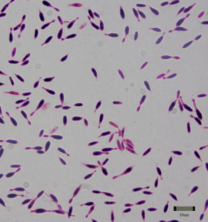 Gram-dodatna bakteria, Bacillus sp. B1(2015b) zdolna do metabolizowania ibuprofenu i naproksenu