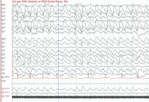 Zapis sygnału EEG człowieka