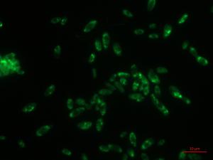 Fotografia komórek szczepu Bacillus thuringiensis B1(2015b) wchodzącego w skład
szczepionki mikrobiologicznej, wybarwionych barwnikiem fluorescencyjnym GFP