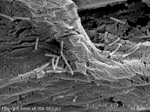Fotografia komórek szczepu Pseudomonas moorei KB4 unieruchomionych
na powierzchni gąbki roślinnej