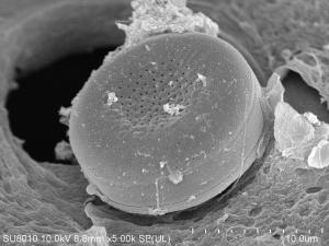Okrzemki na powierzchni gąbki – nadecznika stawowego (Spongilla lacustris L.)